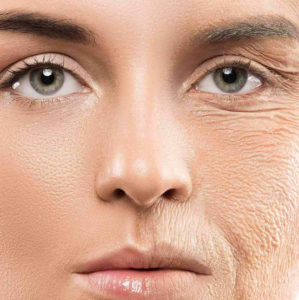 Collagen: uses and prevention of loss